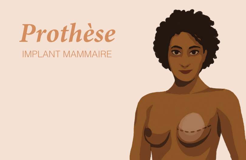 Prothèse interne (implant mammaire)